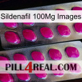 Sildenafil 100Mg Images 10